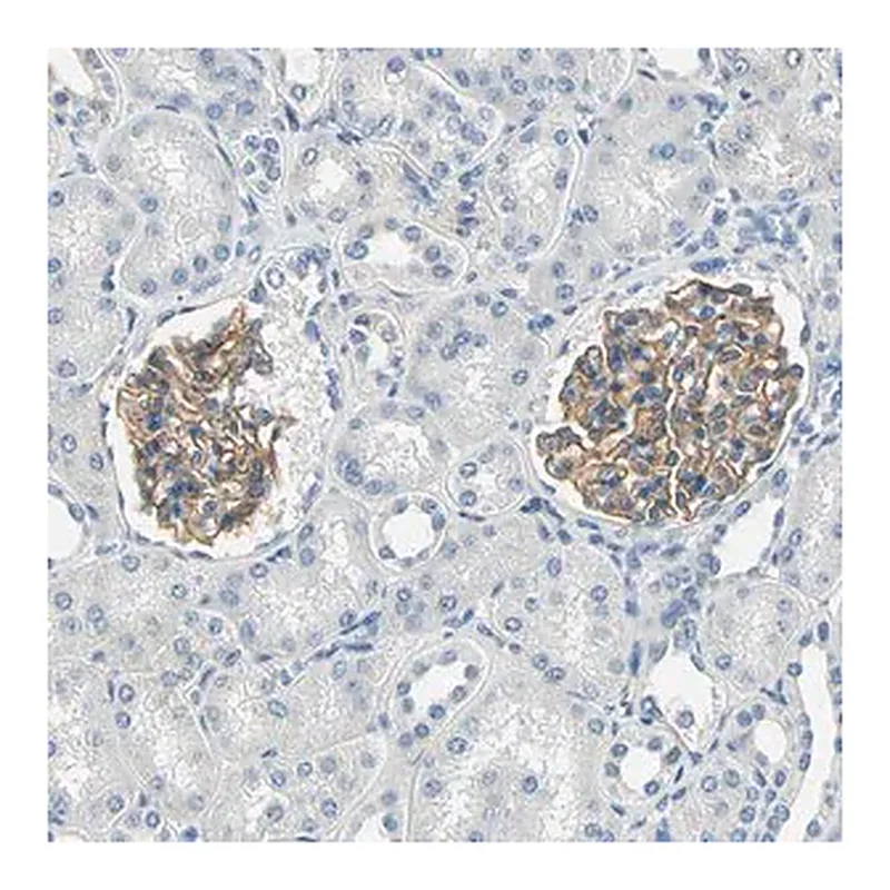 Merck Anti-TGFBR3 antibody produced in rabbit