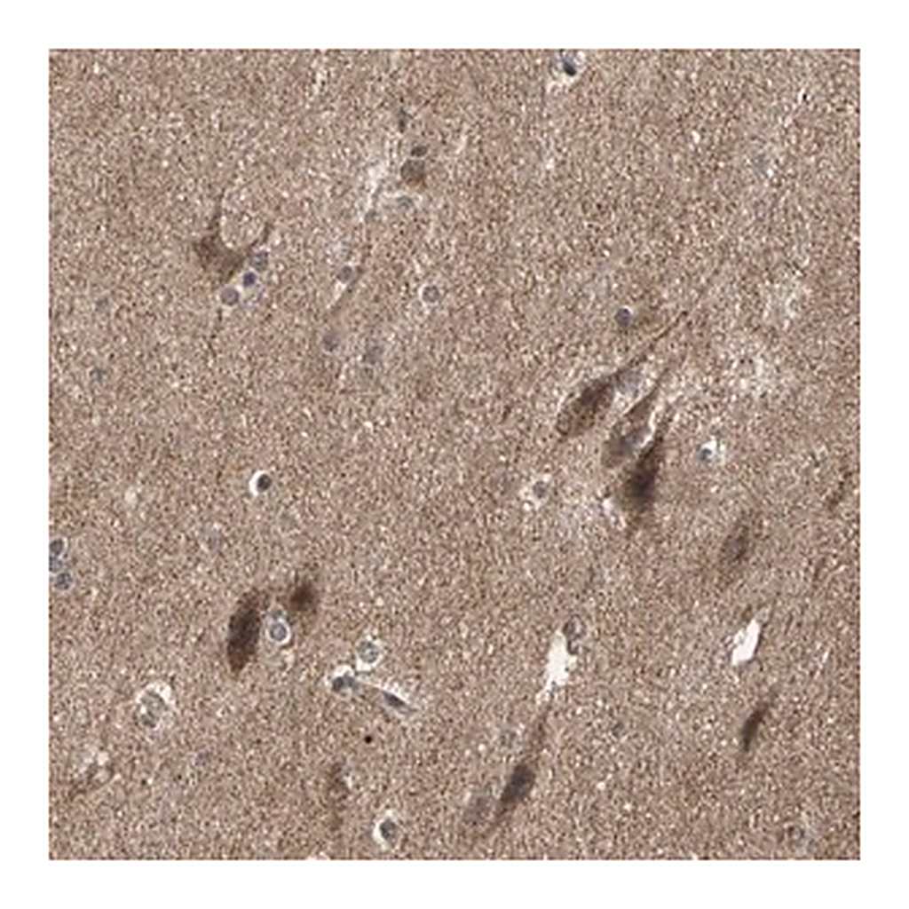 Merck Anti-TAOK1 antibody produced in rabbit