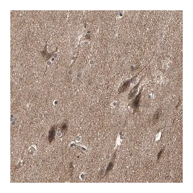 Merck Anti-TAOK1 antibody produced in rabbit