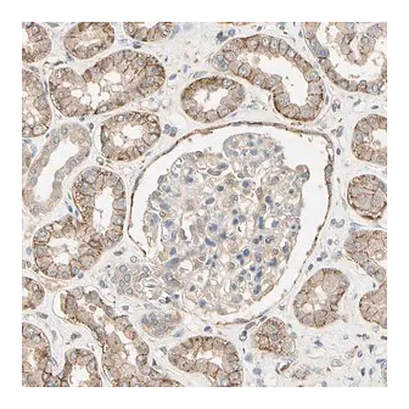 Merck Anti-CDH6 antibody produced in rabbit