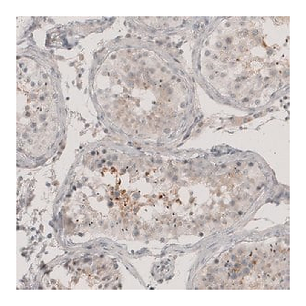 Merck Anti-CT83 antibody produced in rabbit
