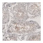 Merck Anti-CT83 antibody produced in rabbit