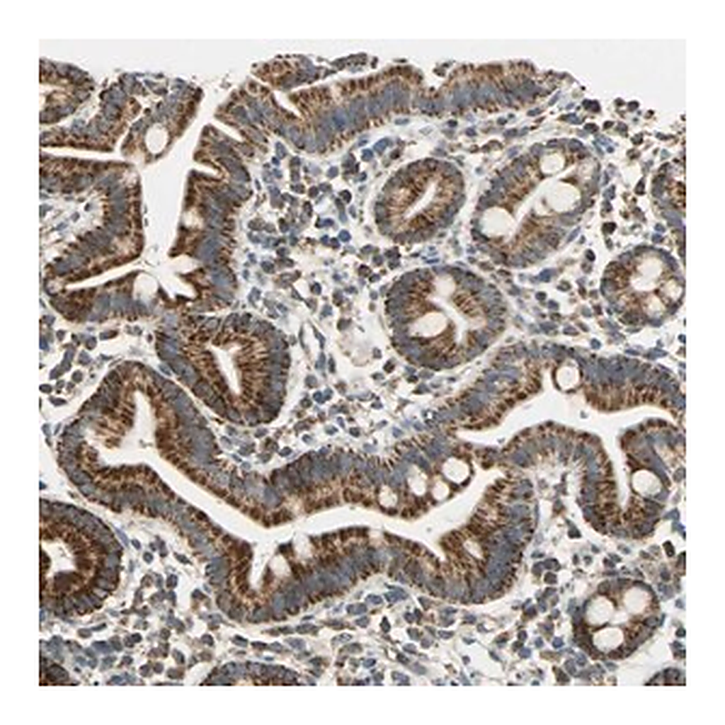 Merck Anti-HDHD5 antibody produced in rabbit
