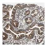 Merck Anti-HDHD5 antibody produced in rabbit