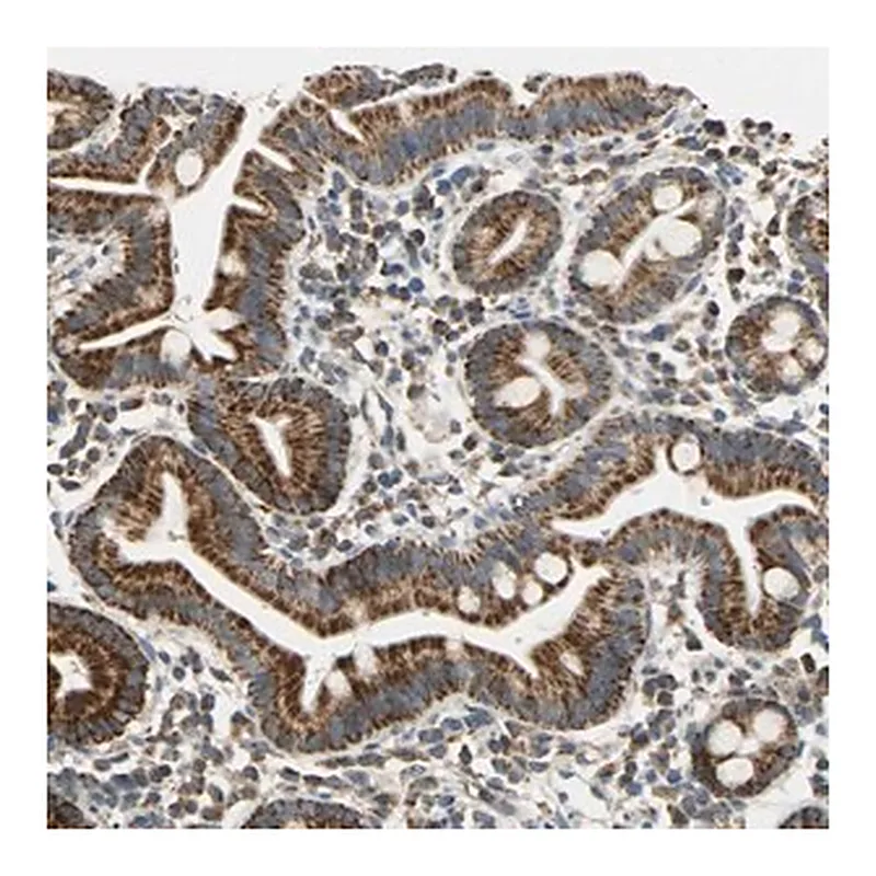 Merck Anti-HDHD5 antibody produced in rabbit