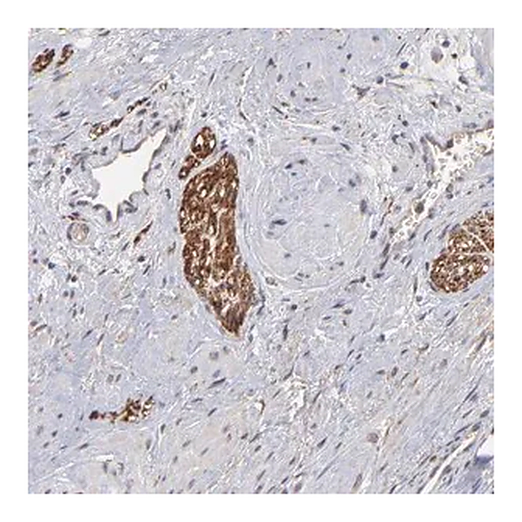 Merck Anti-CHL1 antibody produced in rabbit