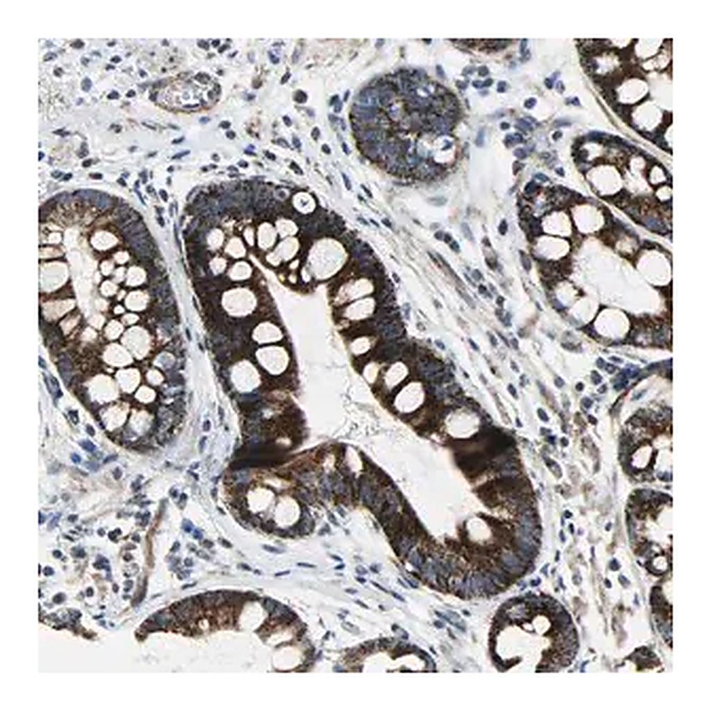 Merck Anti-CHI3L2 antibody produced in rabbit