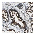 Merck Anti-CHI3L2 antibody produced in rabbit