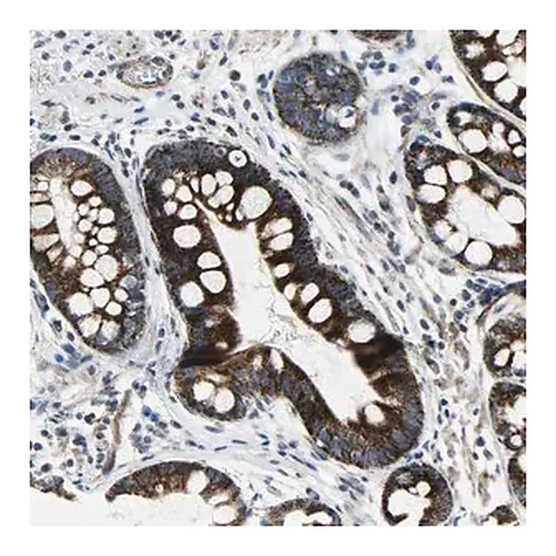 Merck Anti-CHI3L2 antibody produced in rabbit