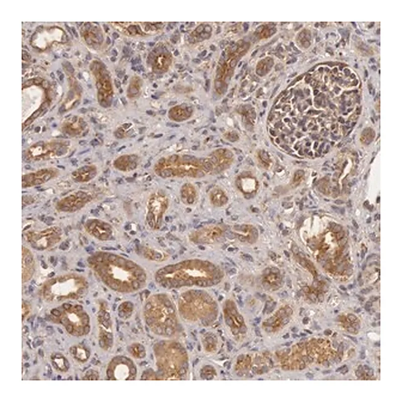 Merck Anti-CHUK antibody produced in rabbit