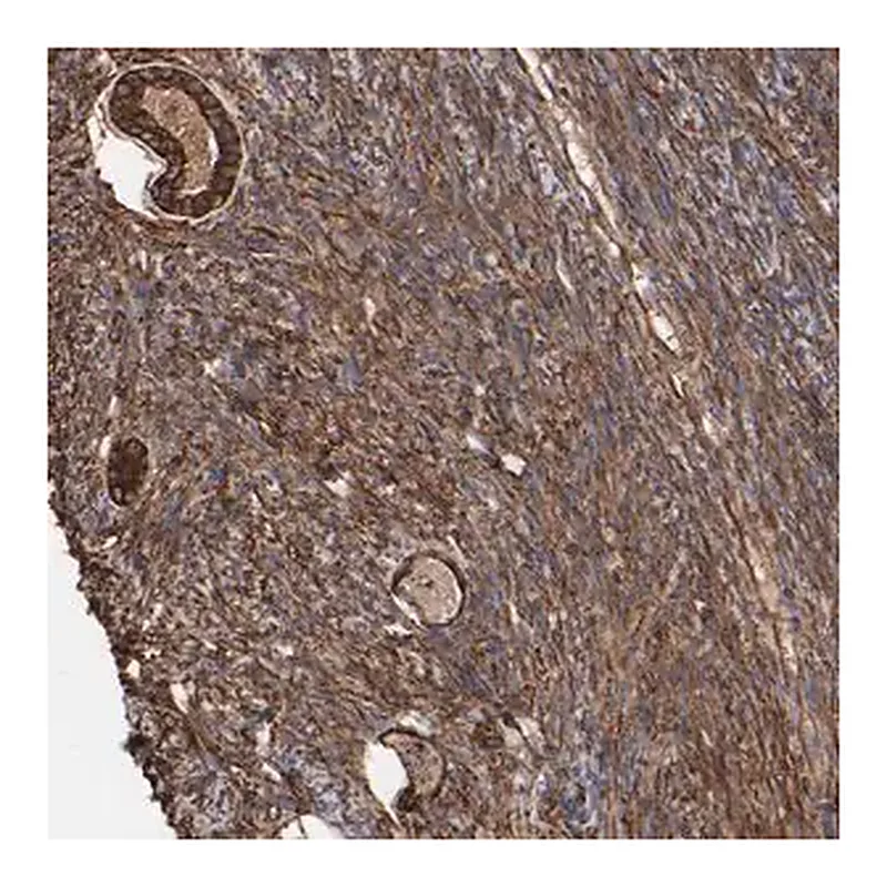 Merck Anti-CILP antibody produced in rabbit