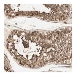 Merck Anti-CNOT4 antibody produced in rabbit