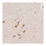 Merck Anti-CLCN5 antibody produced in rabbit