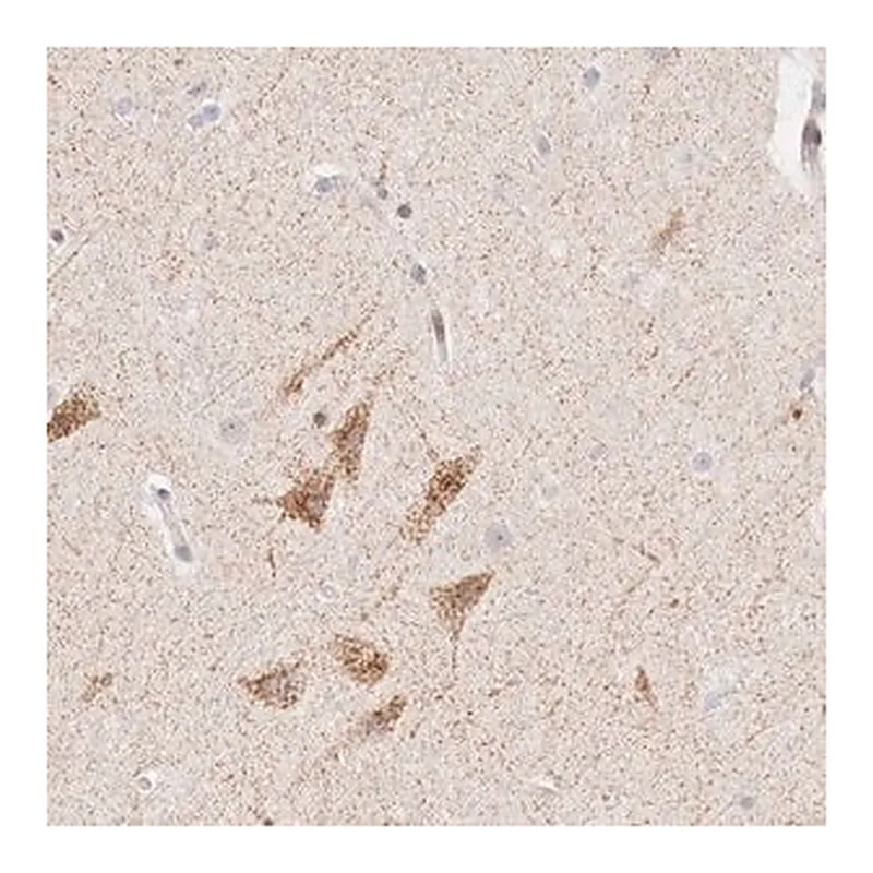 Merck Anti-CLCN5 antibody produced in rabbit