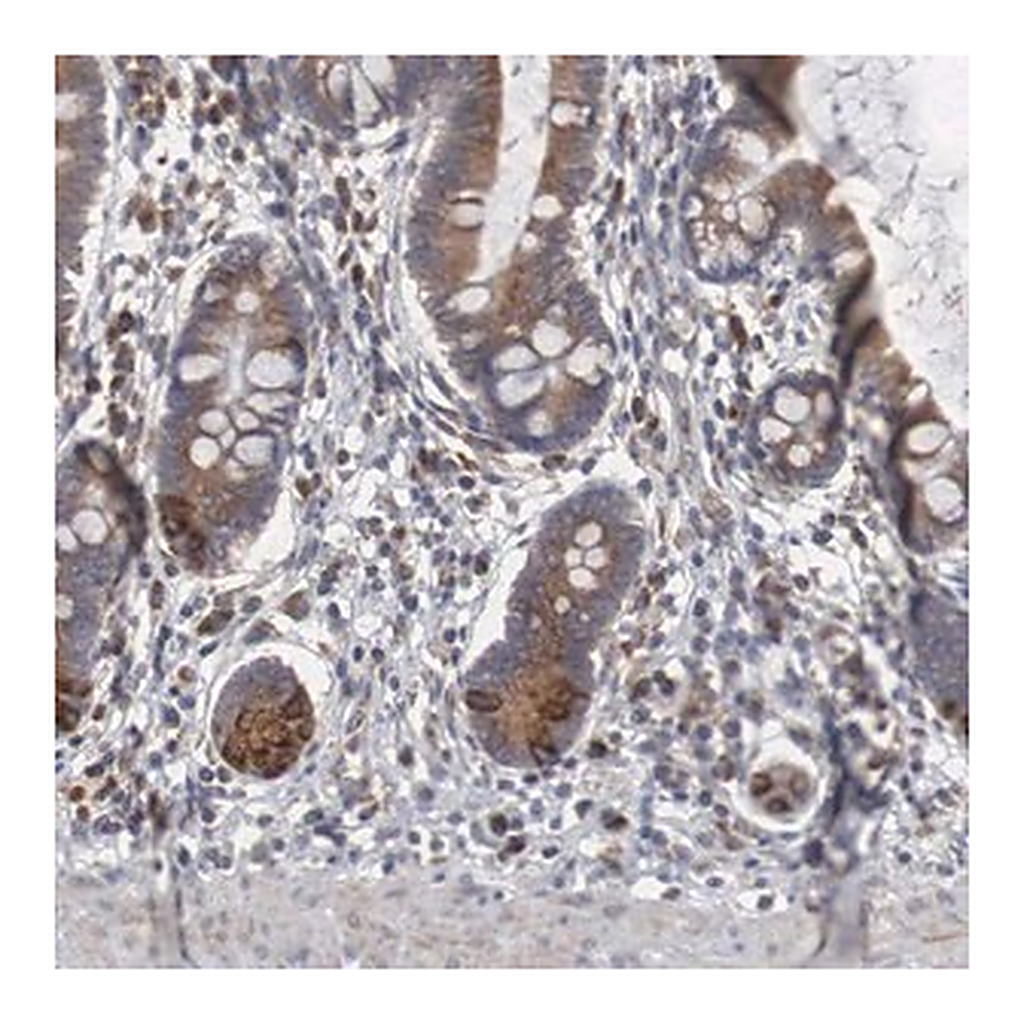 Merck Anti-CTAGE5 antibody produced in rabbit