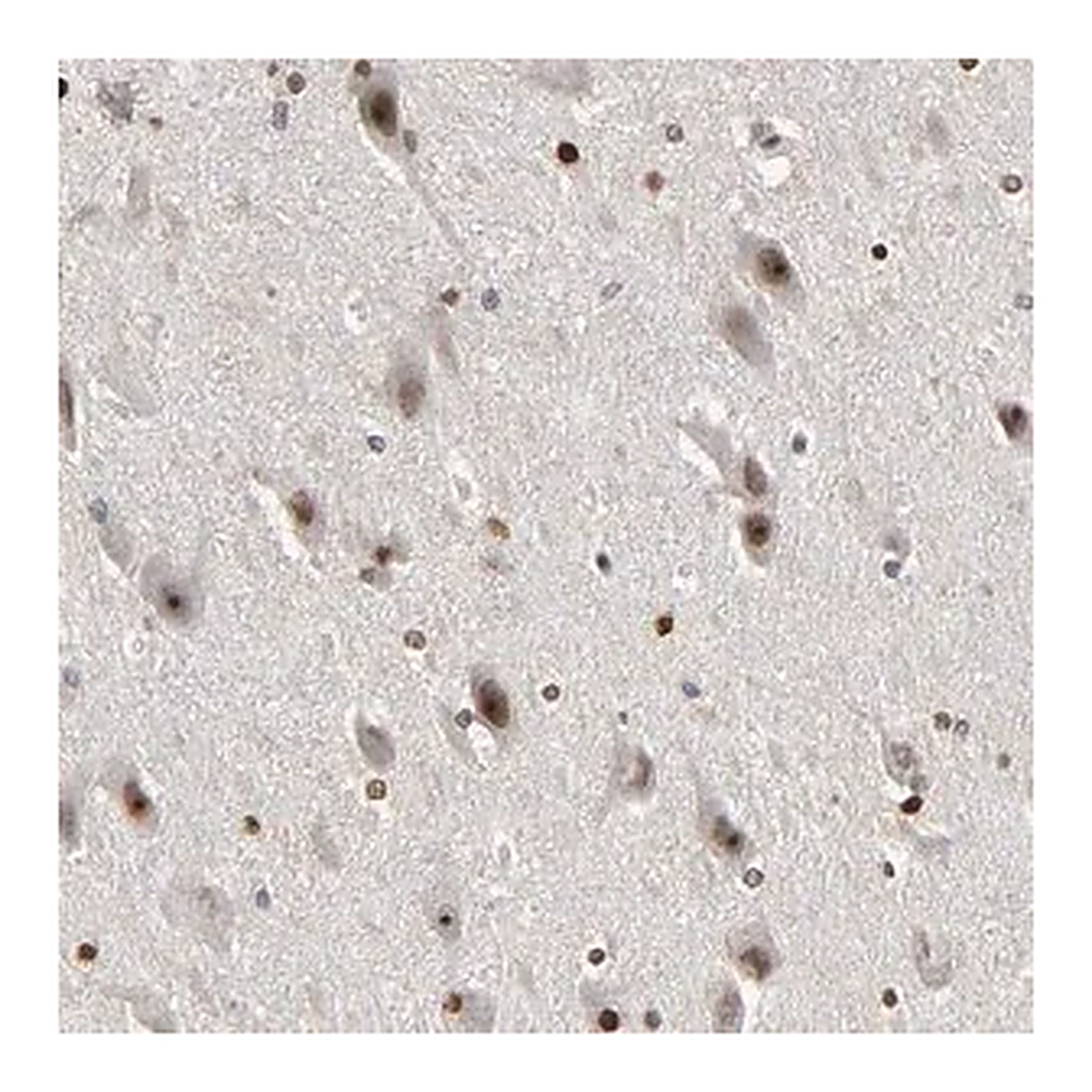 Merck Anti-CPN2 antibody produced in rabbit