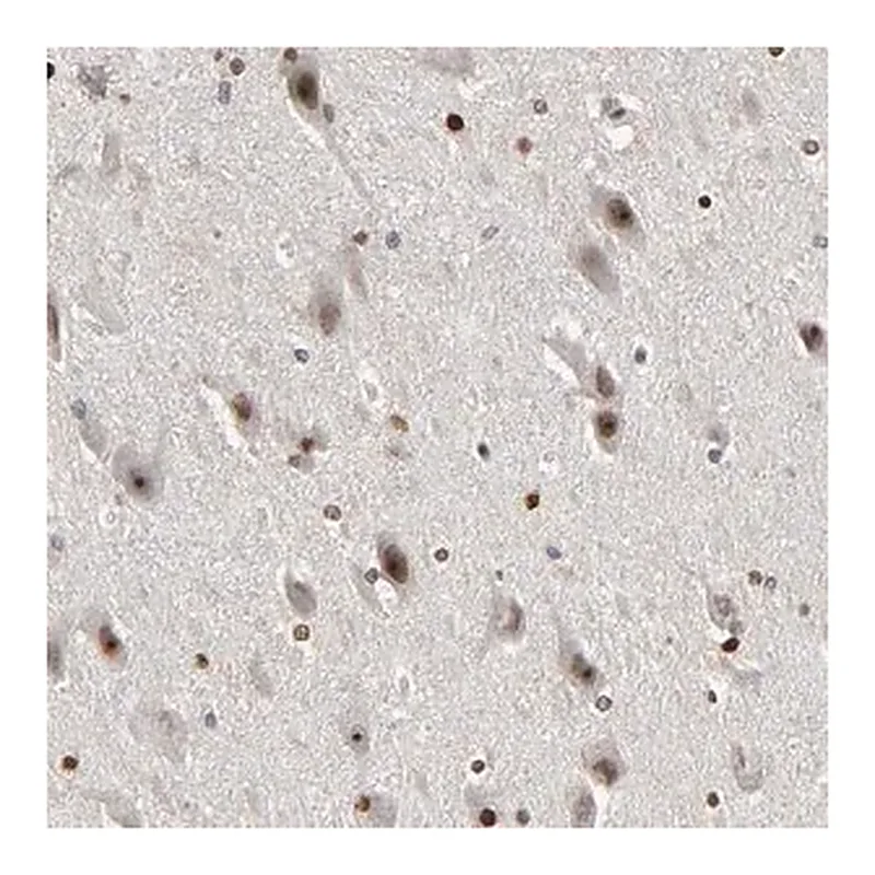 Merck Anti-CPN2 antibody produced in rabbit