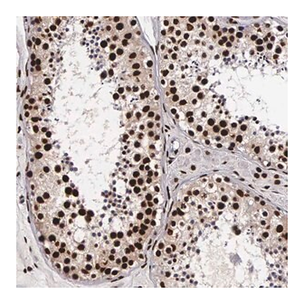 Merck Anti-PABPN1 antibody produced in rabbit