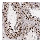 Merck Anti-PABPN1 antibody produced in rabbit