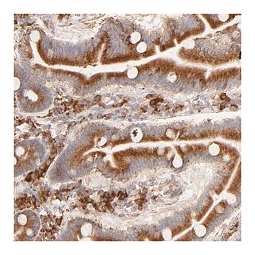 Merck Anti-PARP12 antibody produced in rabbit