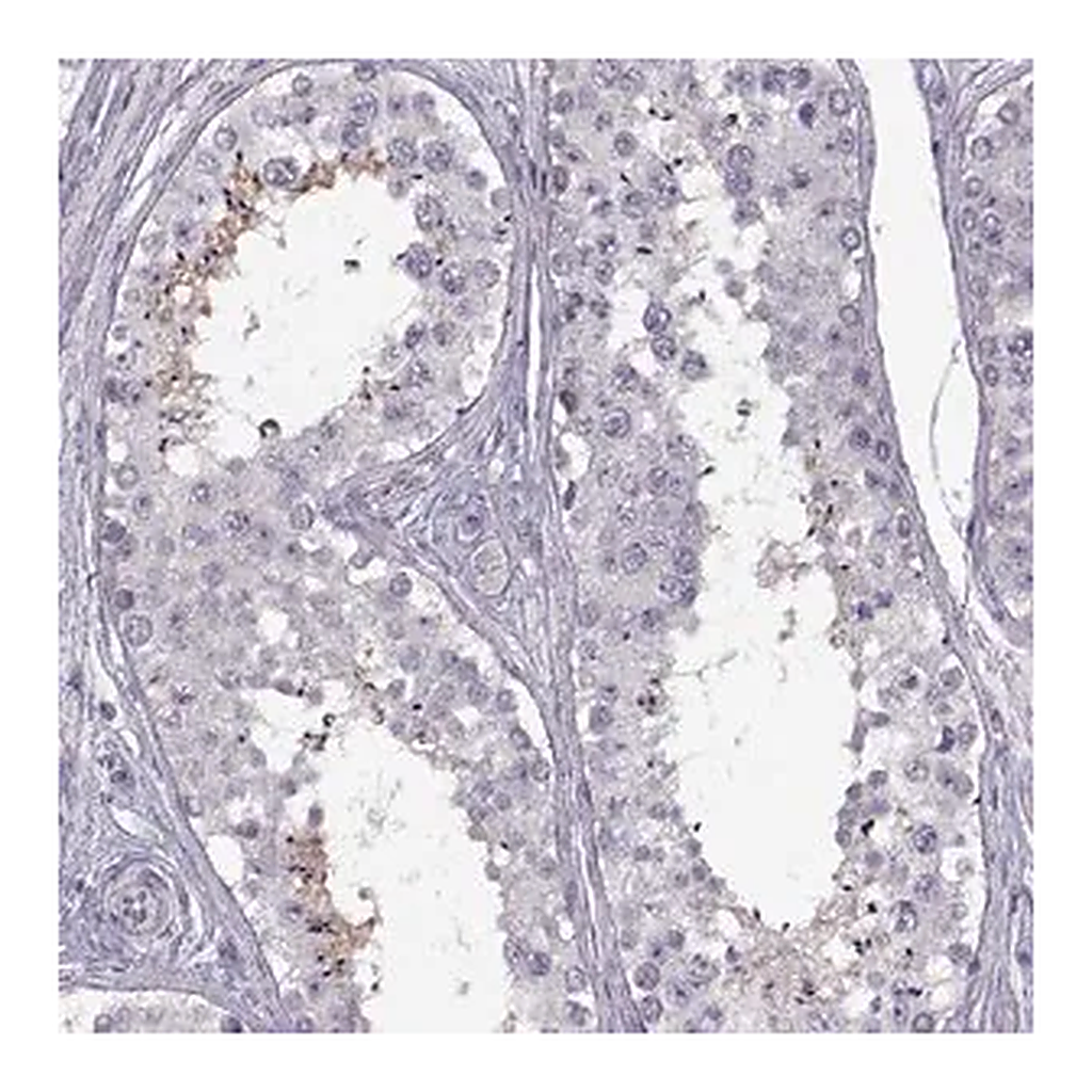 Merck Anti-HYPM antibody produced in rabbit