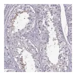Merck Anti-HYPM antibody produced in rabbit