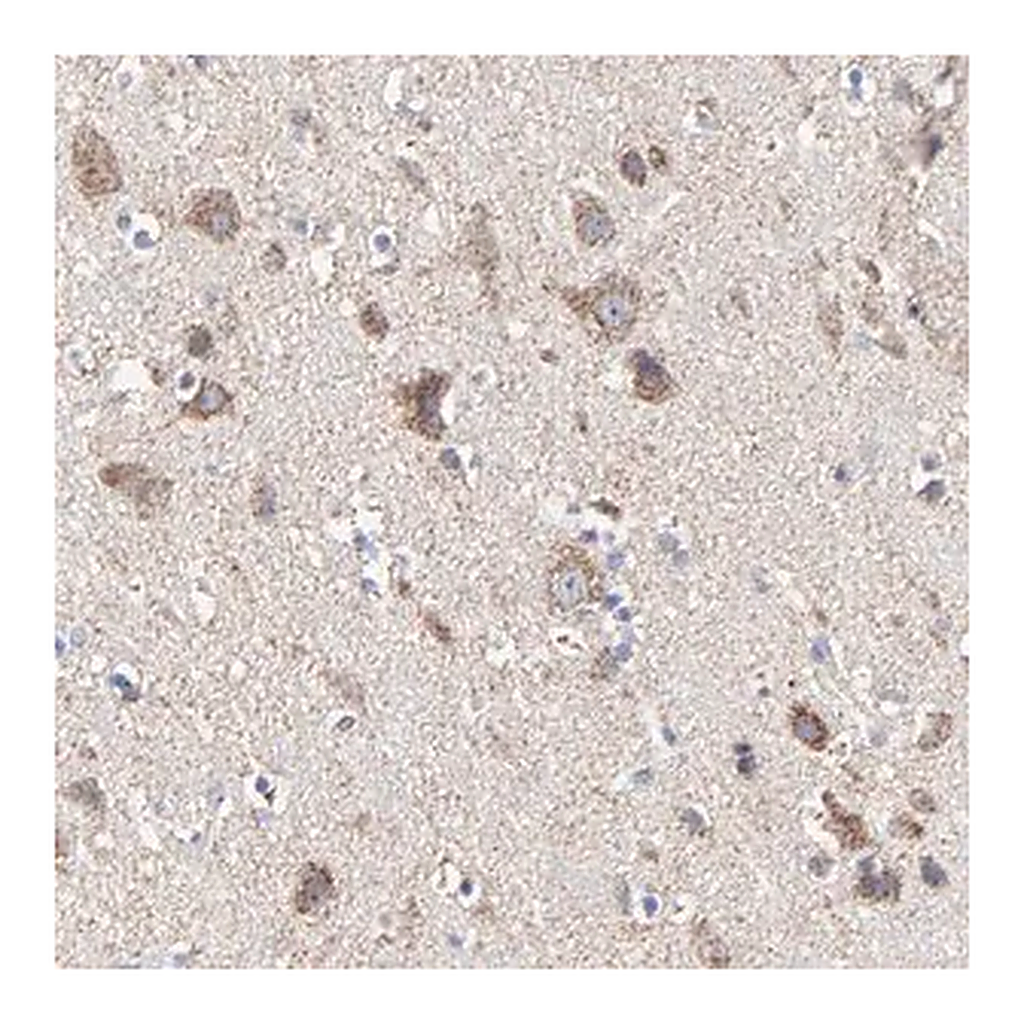 Merck Anti-PINK1 antibody produced in rabbit