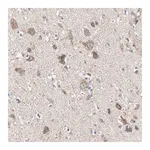 Merck Anti-PINK1 antibody produced in rabbit