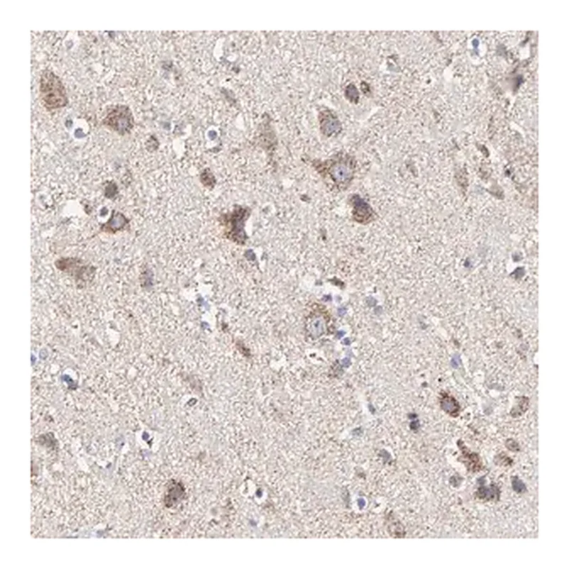 Merck Anti-PINK1 antibody produced in rabbit