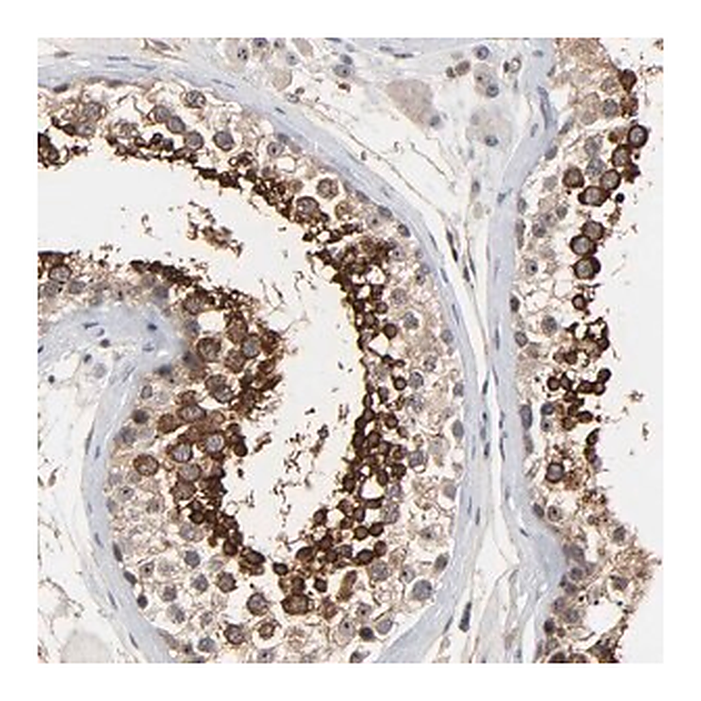 Merck Anti-DDX10 antibody produced in rabbit