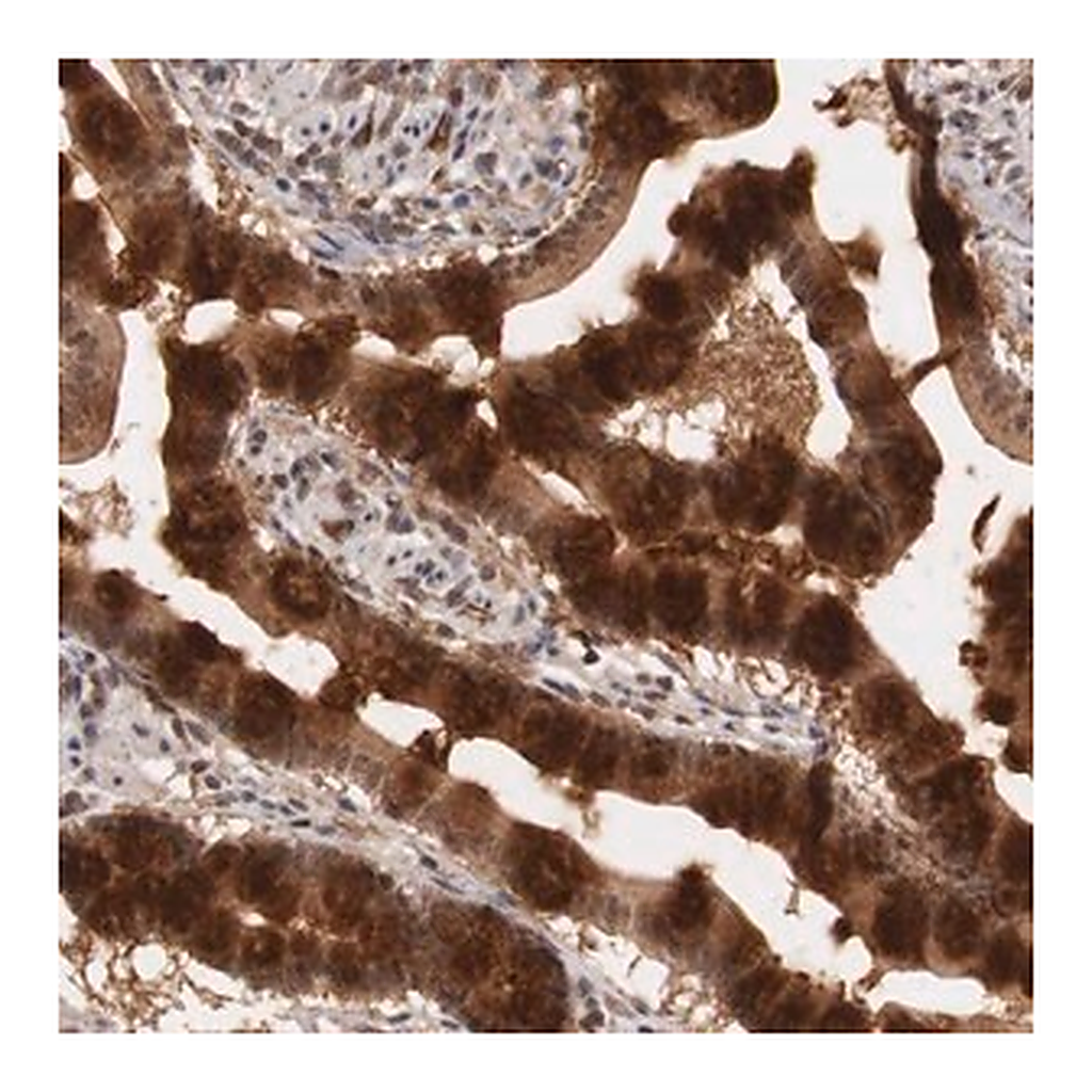 Merck Anti-PLEKHA1 antibody produced in rabbit