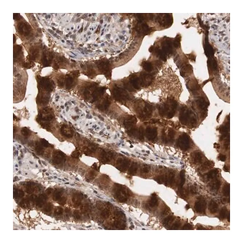 Merck Anti-PLEKHA1 antibody produced in rabbit