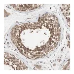 Merck Anti-DPP8 antibody produced in rabbit