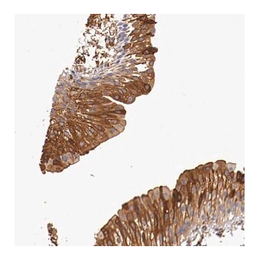 Merck Anti-PITPNB antibody produced in rabbit