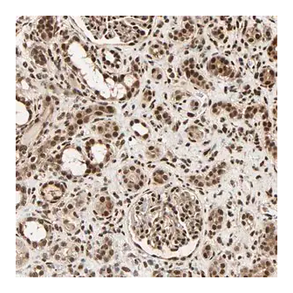 Merck Anti-PNPLA6 antibody produced in rabbit