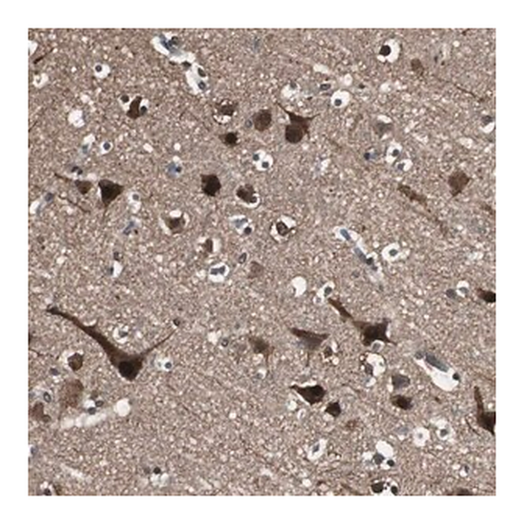 Merck Anti-PPP1R13B antibody produced in rabbit