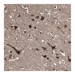 Merck Anti-PPP1R13B antibody produced in rabbit