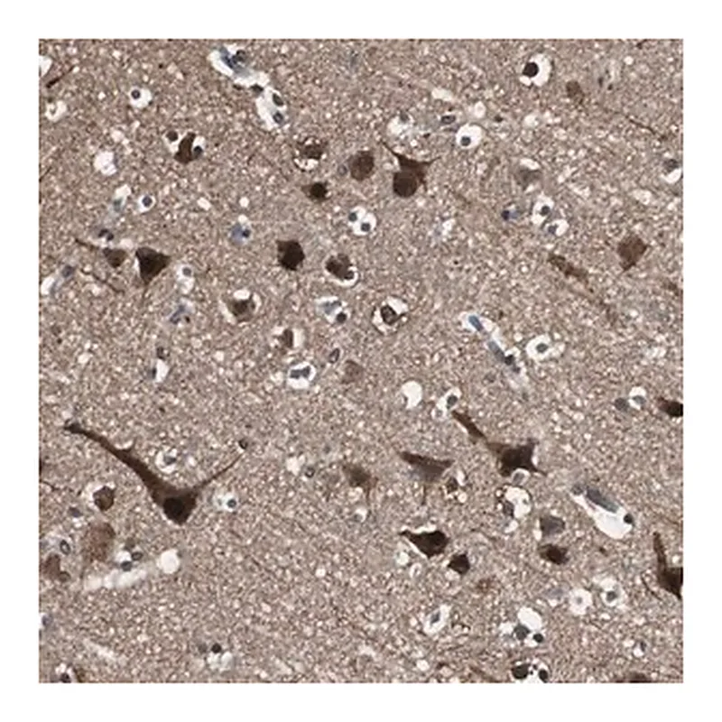 Merck Anti-PPP1R13B antibody produced in rabbit
