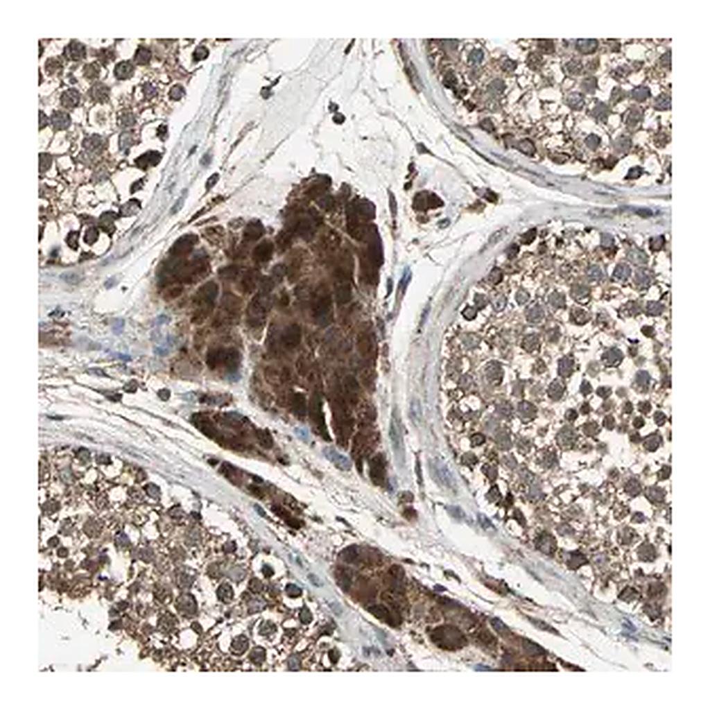 Merck Anti-POLRMT antibody produced in rabbit