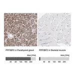 Merck Anti-PPFIBP2 antibody produced in rabbit