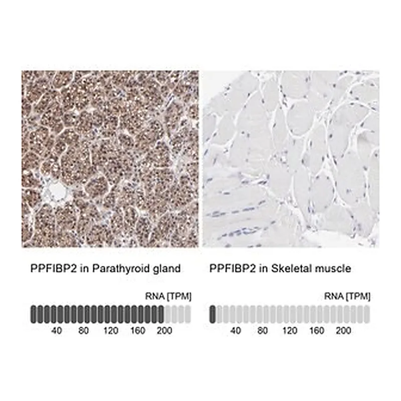 Merck Anti-PPFIBP2 antibody produced in rabbit