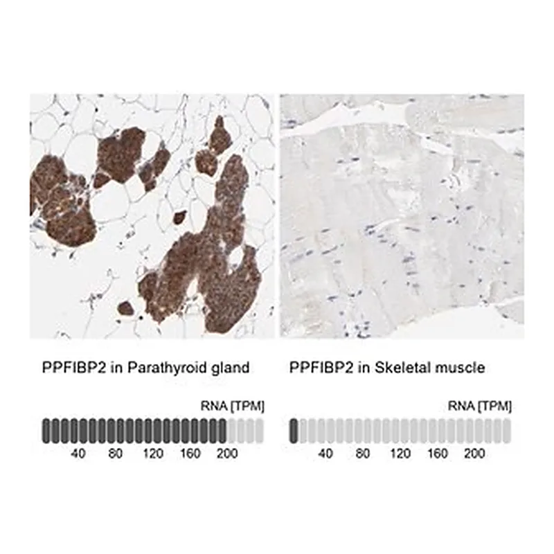 Merck Anti-PPFIBP2 antibody produced in rabbit