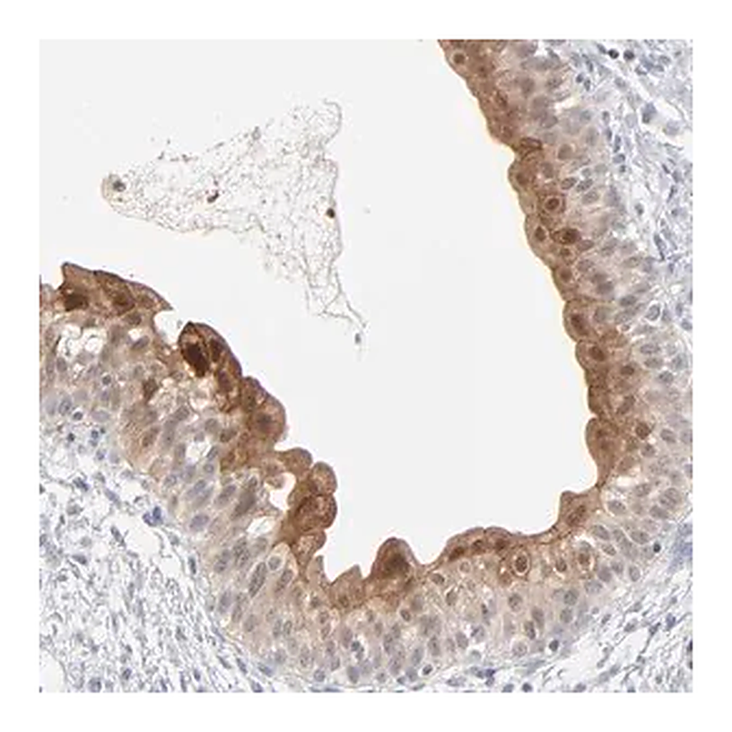 Merck Anti-POF1B antibody produced in rabbit