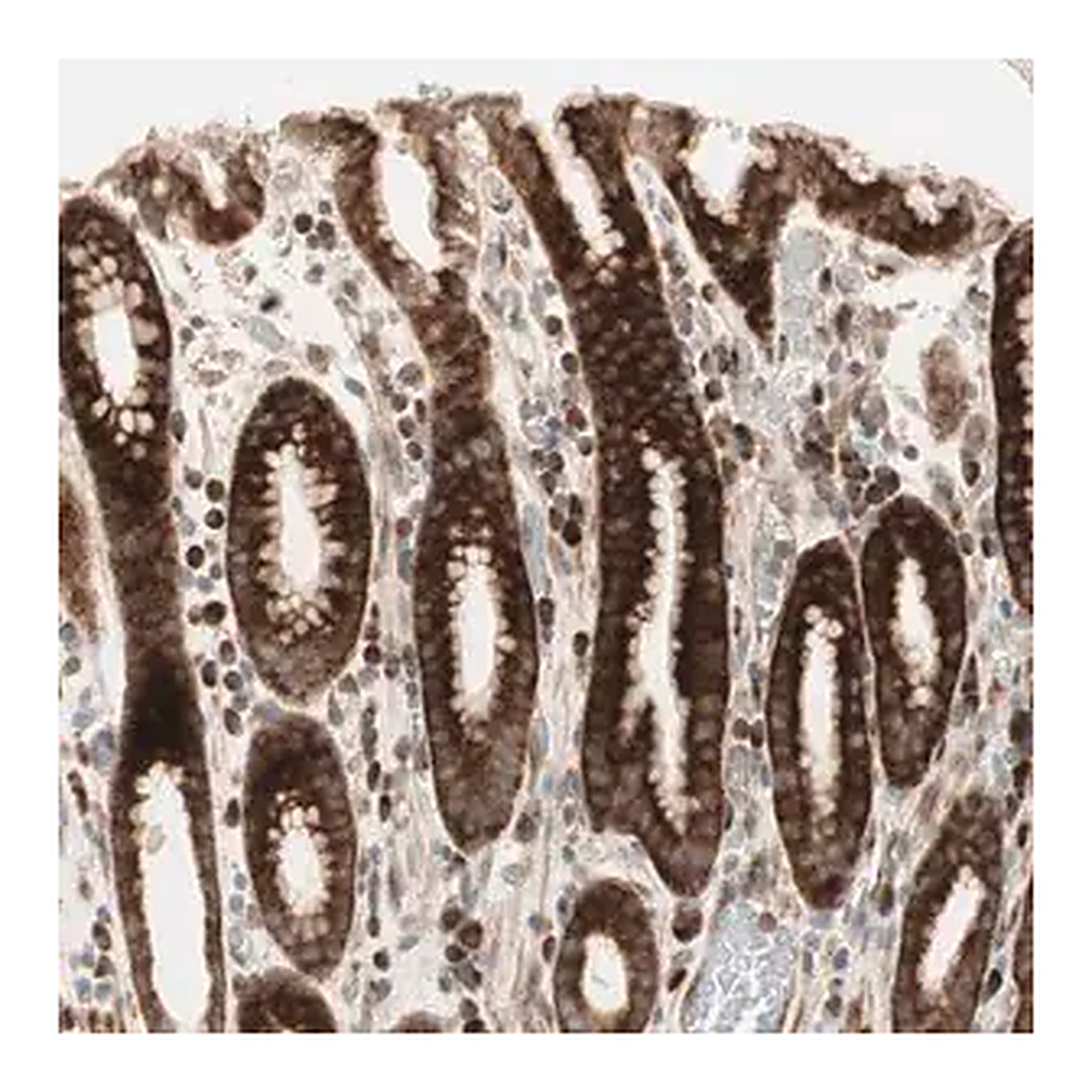 Merck Anti-PPP2R5E antibody produced in rabbit