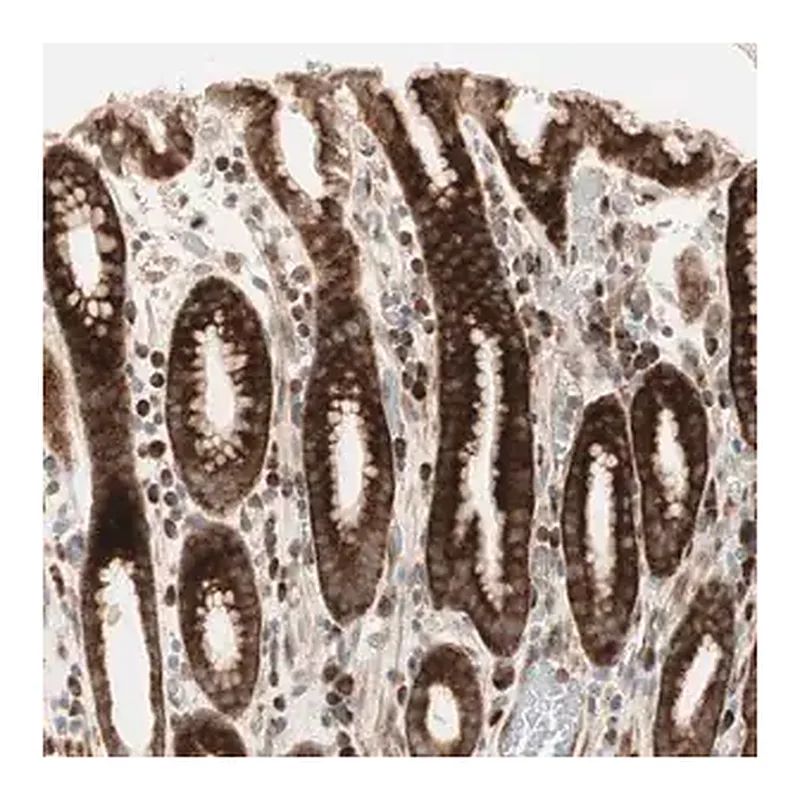Merck Anti-PPP2R5E antibody produced in rabbit