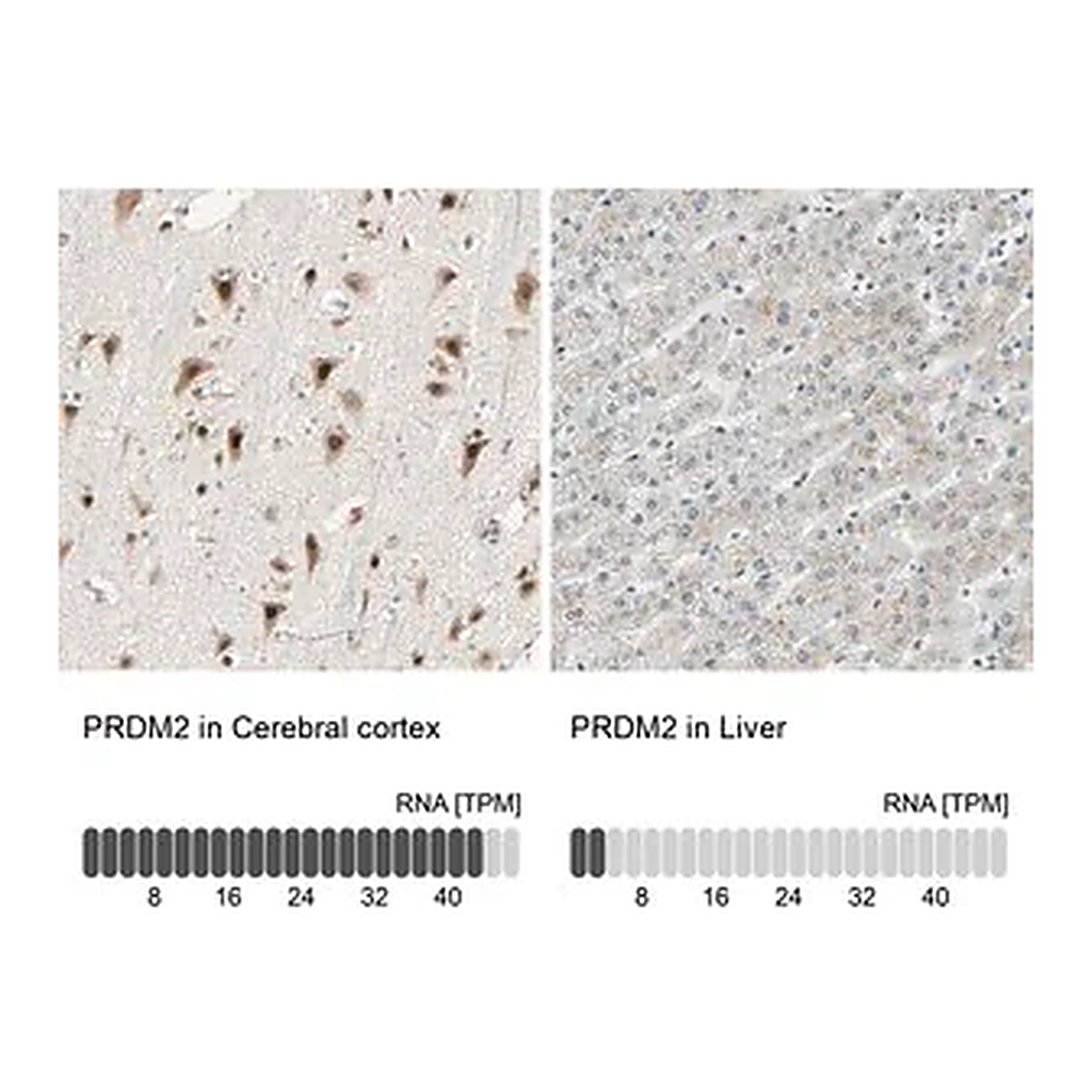 Merck Anti-PRDM2 antibody produced in rabbit