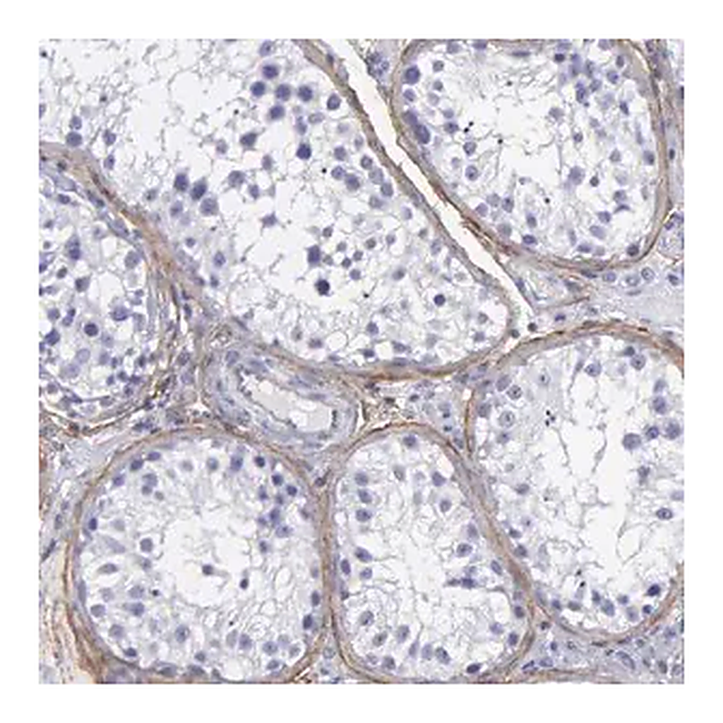 Merck Anti-FBLN5 antibody produced in rabbit