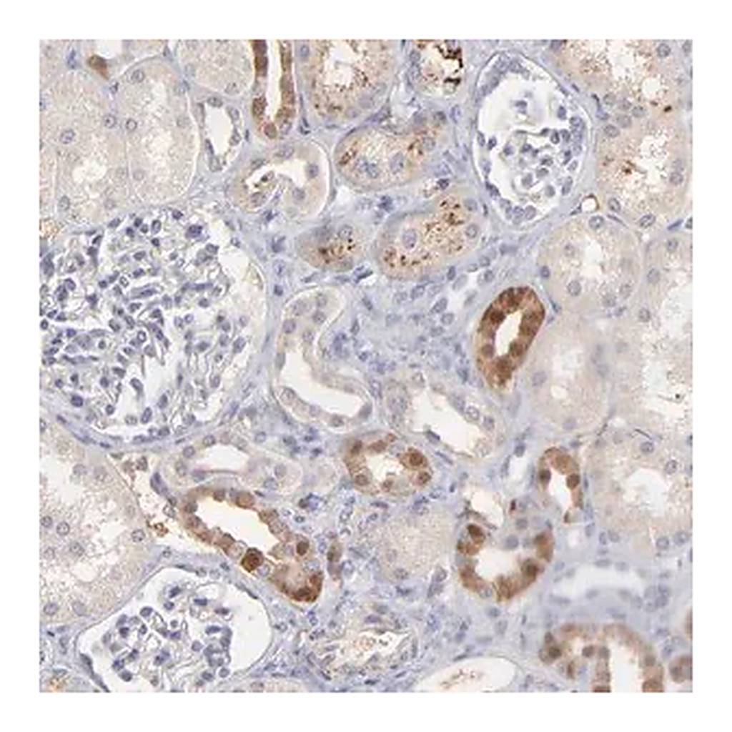 Merck Anti-F13B antibody produced in rabbit