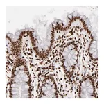 Merck Anti-FBXO18 antibody produced in rabbit
