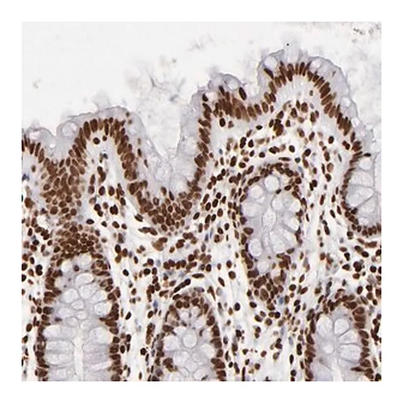 Merck Anti-FBXO18 antibody produced in rabbit